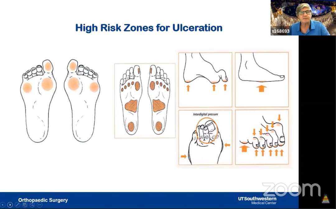 drhiteshg's tweet photo. https://t.co/X2LpzHujxf Diabetic Foot
#orthotwitter #medtwitter #oite #abos #frcsorth #frcs #fracs #frcsc #msorth #dnborth https://t.co/feVe5JbjWm