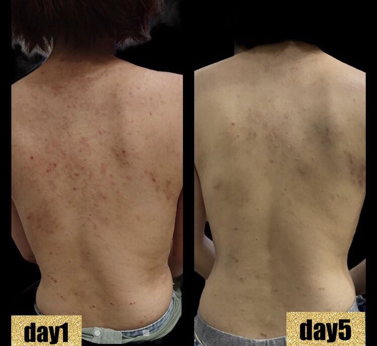 NOROSHIDANCE's tweet image. 紀州備長炭CBDバームの最終サンプルが上がります😀✌️

ご予約されてる方もう暫くお待ちを〜

#紀州備長炭　#CBD #SWAGLAB