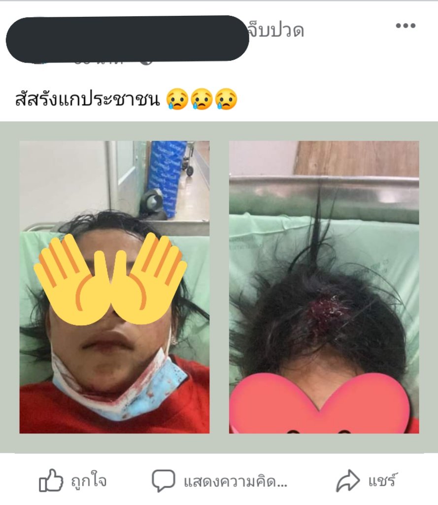 fix tweet media