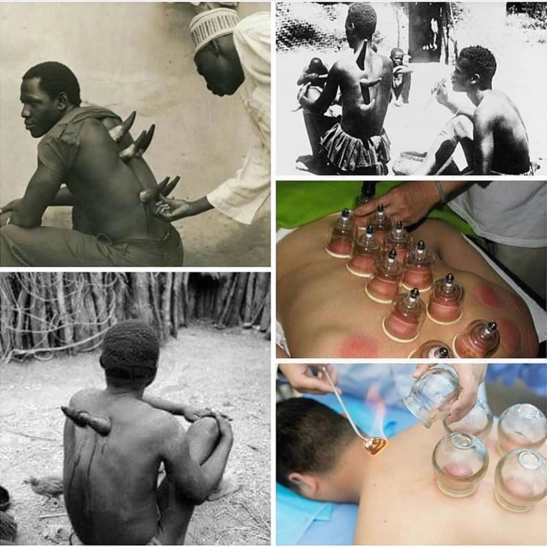 Medical body therapy was invented in Africa. Today it is the basis for medical practices such as chiropractic work, reflexology, craniosacral therapy, postural integration, shiatsu, ect.