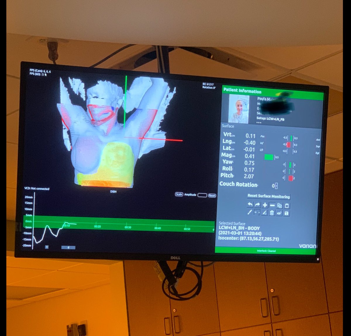 PaulaMaier3's tweet photo. A reminder that it’s the first of the month.
A perfect day to do your monthly self breast exam.
Find tutorial on UTube if you need one.
Knowledge is power and will help you stay on top of health issues.
#checkyourboobs #selfbreastexam #checkyourmelons https://t.co/F8eobHxq8s