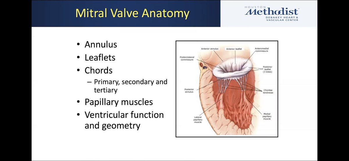 spandatmd's tweet photo. Learning the essentials of Mitral Valve A&amp;P and MR mechanisms with @SLittleMD  #MitraClip #CVBootCamp2021 #cardiotwitter #MedEd #ACCFIT https://t.co/ADbp5uXWH0