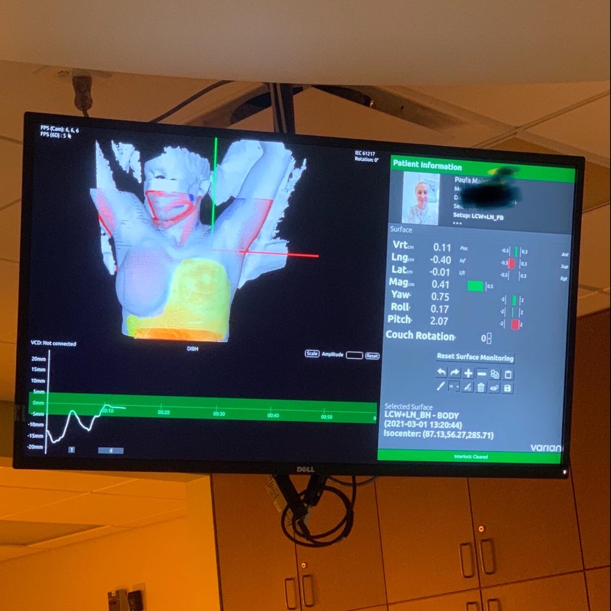 PaulaMaier3's tweet photo. It’s the beginning of the month- check your breasts for a change in shape, size, color.
https://t.co/mrv91tSLpH #checkyourmelons #breastcancer https://t.co/H6n05dGKin