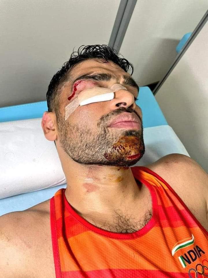 RSS_Sakthi's tweet image. பாரதத்தின்
குத்துச்சண்டை வீரரான 
சதீஷ் குமார் அவர்கள்
டோக்கியோ
ஒலிம்பிக்கில் முதல் போட்டியில் வென்றார், முதல் சுற்றில் ஏற்பட்ட கடும் காயம் காரணமாக அடுத்த சுற்று விளையாட முடியாத நிலை ஏற்பட்டது 11 தையல் இருந்தும் வீரத்தோடு புறமுதுகு காட்டாமல் எதிரியை வெல்ல தாய் நாட்டிற்காக சென்றார்