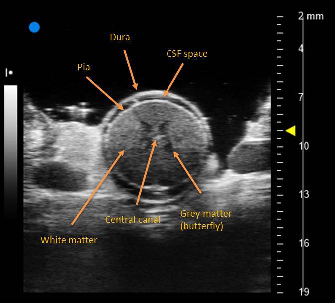 FujifilmUS's tweet photo. From FUJIFILM @VisualSonics: Something cool for your Sunday! Check out this swine spinal cord imaging using the Vevo 3100 and our 4D software! Watch the rendering video: https://t.co/FDBTwRvihi

#visualsonics #Vevo3100 #4Dimaging #highfrequency #ultrasound #preclinical https://t.co/qSUTPYp6If
