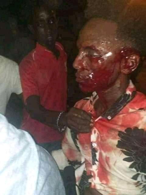 CammaduQafar's tweet photo. The genocide that Djibouti's government is inflicting on the innocent Afars of Djibouti should not go unnoticed.

￼ https://t.co/8p4GdUzCo3