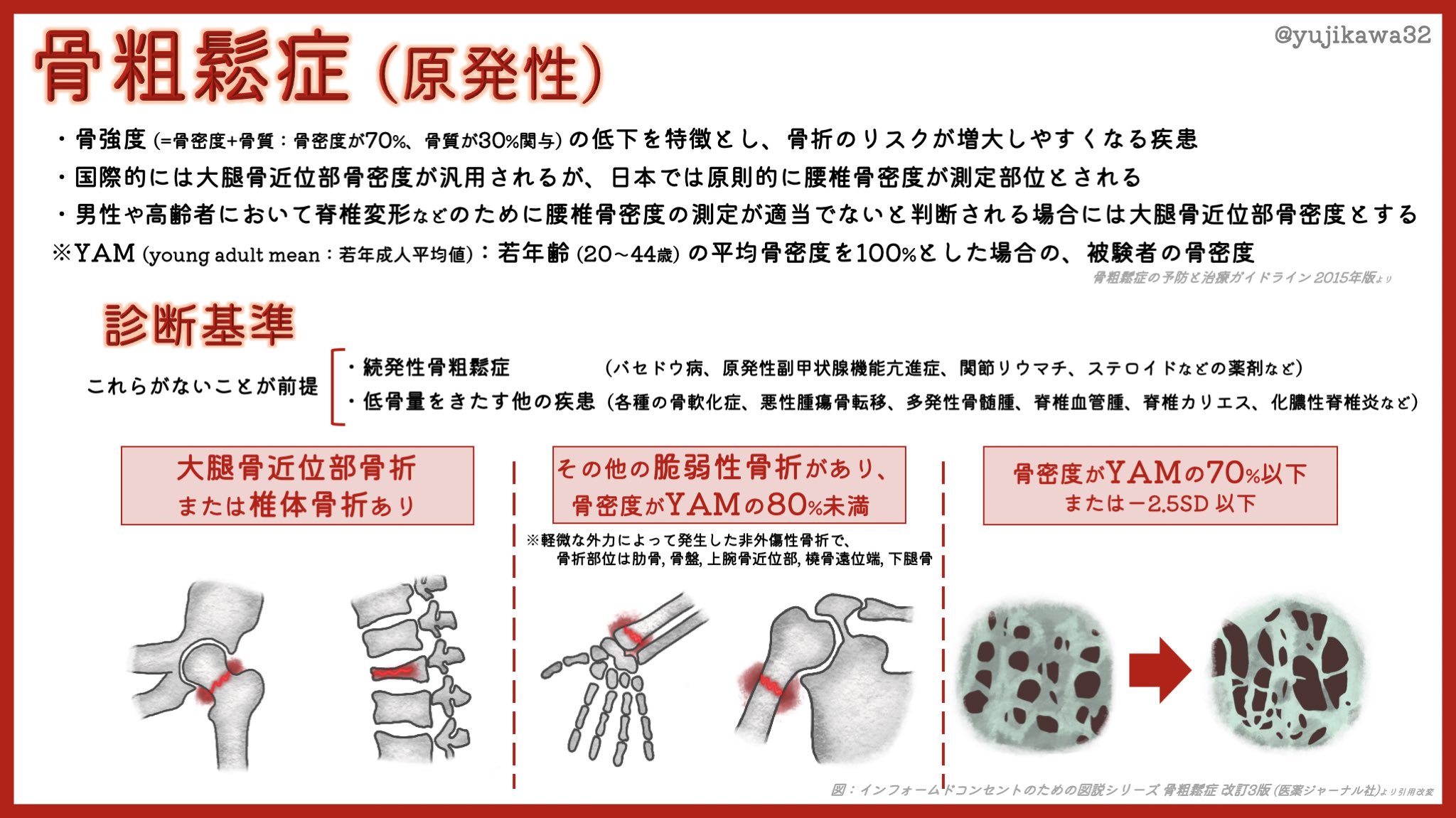 骨粗鬆症 Twitter Search Twitter