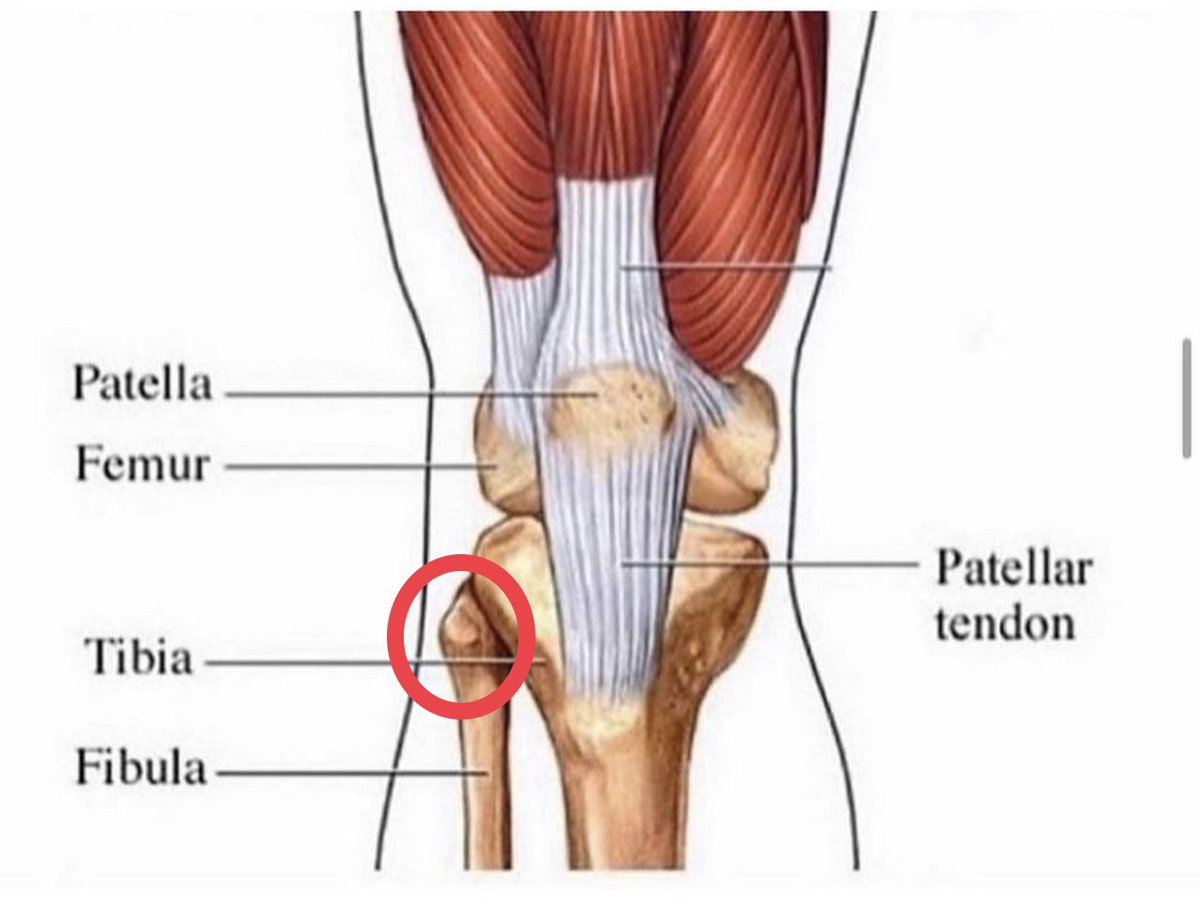 Сухожилие четырехглавой мышцы колена