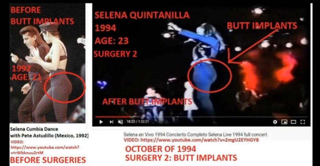 Selena Quintanilla b4&after 1994 butt surgeries
https://t.co/FOvy0CV29a

1994&1995
-Spn news media confronted Selena about-butt implants surgery.
https://t.co/Cg0ArrFwHS

