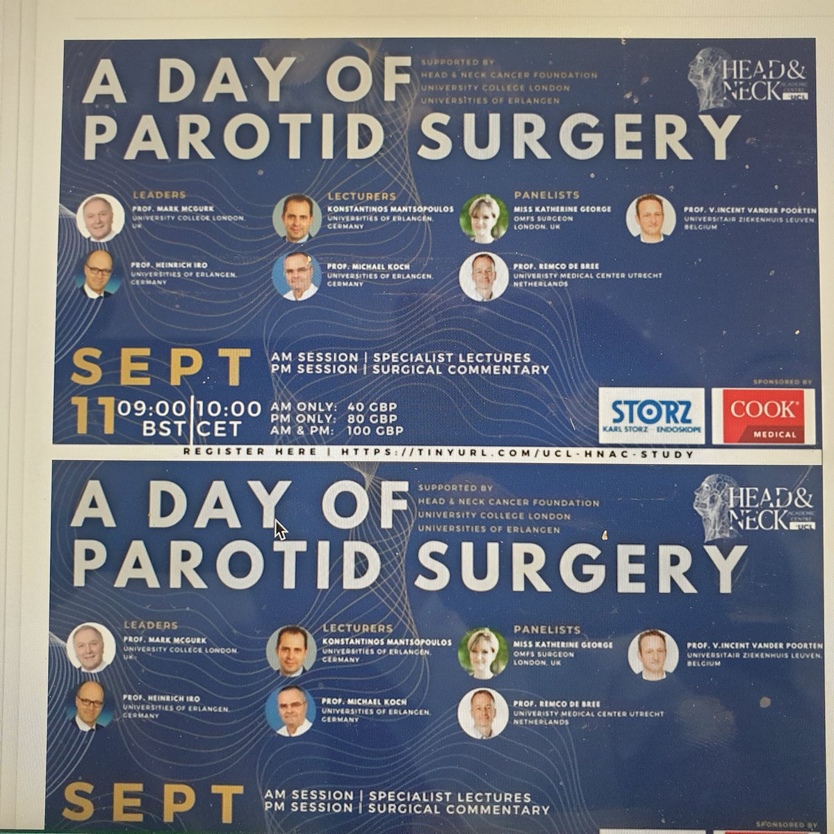 Exciting day of live parotid surgery. Showing open retrieval of parotid stones: Hologram images tracing the facial nerve. How to do the Extended ECD,  traditional parotidectomy: parapharyngeal tumours. Please join us.#parotidsurgery
#bahno #baoms
