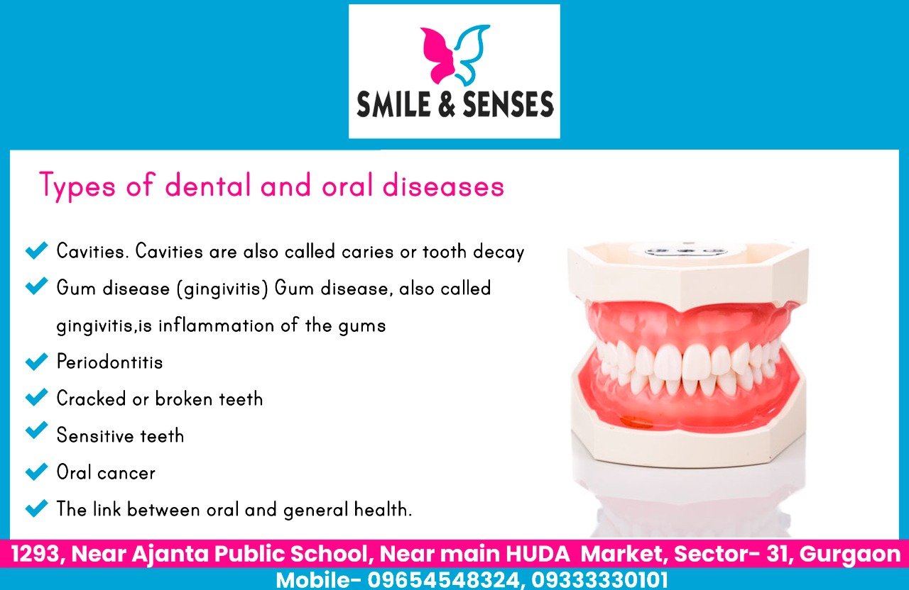 types of oral diseases