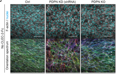 ActonLab's tweet photo. But also that #podoplanin (arguable our favourite protein) does a lot more in the fibroblastic stroma than just contractility (as we previously published (https://t.co/BEOCG9vqeS)
Also controls polarity, alignment, and cell-cell interactions, all key features of the #FRCnetwork https://t.co/K1EXAJ3R8L