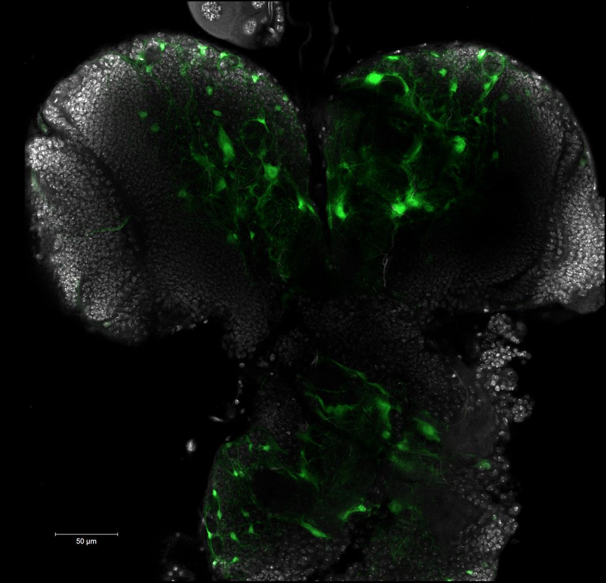 NeuroAlc's tweet photo. #SciencePhoto_IN
"Localizacion de las neuronas que expresan CG7430 en el cerebro y lóbulos ópticos de Drosophila melanogaster"
Autor: Juan Carranza
Lab: Dr. Javier Morante @Morante_Lab
"CG7430 ha sido predicho que tenga actividad dihidrolipoil deshidrogenasa y unir...1/3 https://t.co/P7uYnEIvhc
