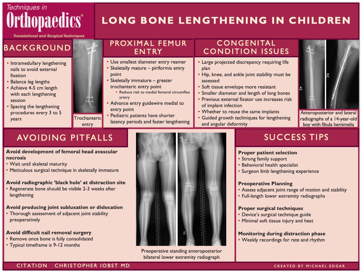 Our latest #VisualAbstract is out! "Long Bone Lengthening in Children”

#Orthopedics #orthotwitter #orthopaedics #orthopedicsurgery
