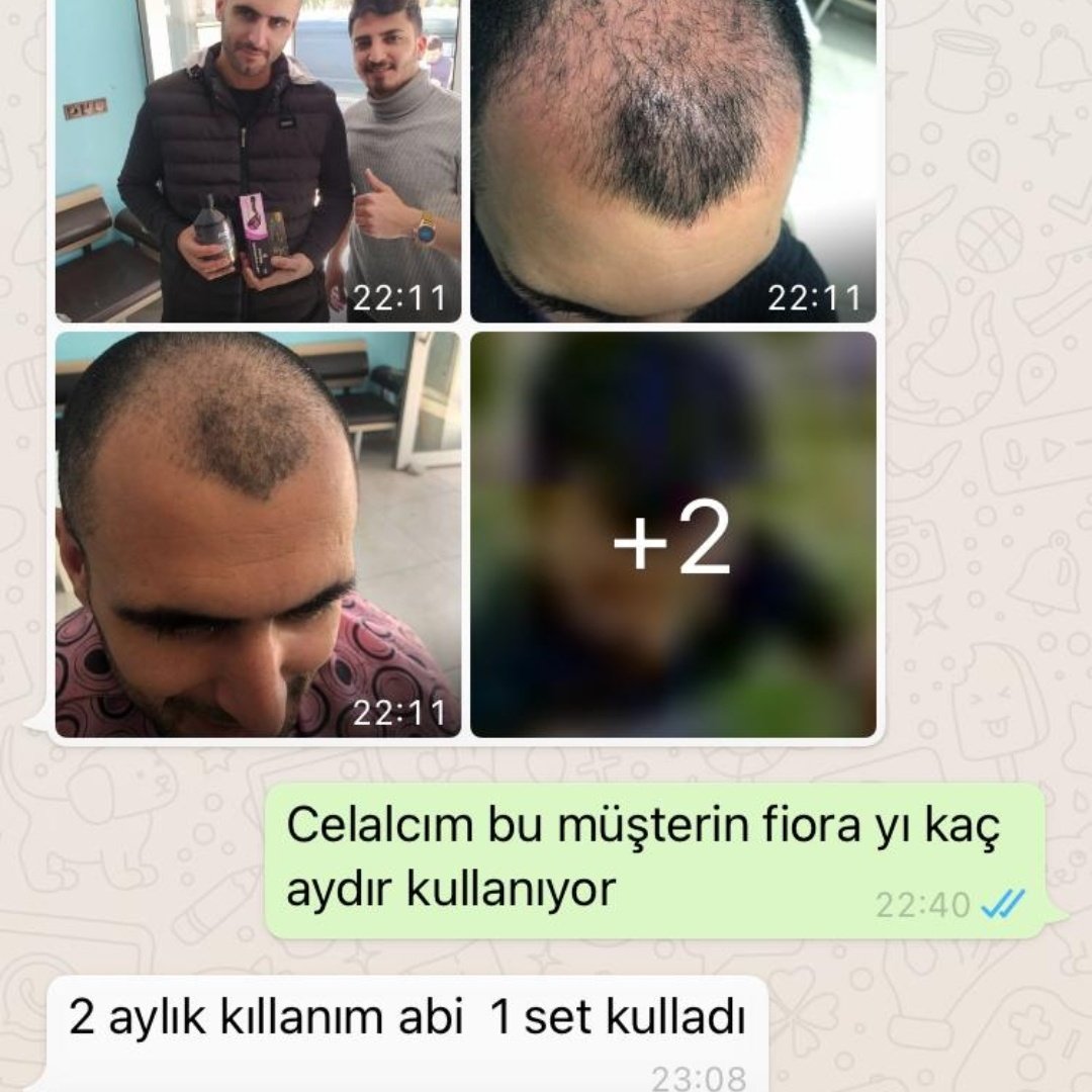 DegisimMucize's tweet photo. Saç ekmiyoruz, çıkartıyoruz 👍
#Sisli #mecidiyekoy #halkali #Taksim #bagcilar #merter #İstanbul #Ankara #izmir #bakirkoy #atakoy #bahcelievler #yenibosna #SONDAKIKA #bakirkoy #halkali #İstanbul #avrupayakasi #hairstyle #saçmodelleri #saç #hairtransformations https://t.co/rdGiNgmt9N