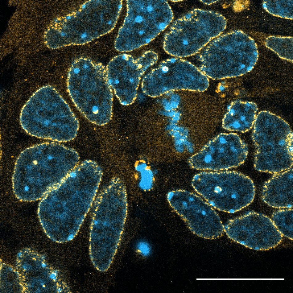 #SummerPic <a href="/IJMonod/">Institut Jacques Monod</a> 
📸 GFP-Nup133 (Orange) and DAPI (Blue) staining in mouse embryonic stem cells at day 5 of neuroectodermal differentiation
From <a href="/COrniacki/">Clarisse Orniacki</a>, <a href="/DoyeValerie/">Valerie Doye</a> / Karess Lab