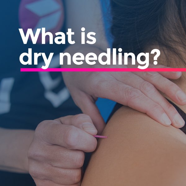 _Renew_Movement's tweet photo. ▪️ During dry needling, a 𝘭𝘪𝘤𝘦𝘯𝘴𝘦𝘥 practitioner inserts filament needles into tight muscles.
▪️ Practitioners place the needles in “trigger points” (areas of muscle knots)
▪️ The needle helps release the knot and relieve any muscle pain. 
▪️ https://t.co/Y83GatPkMZ https://t.co/qI4IiRPyxY