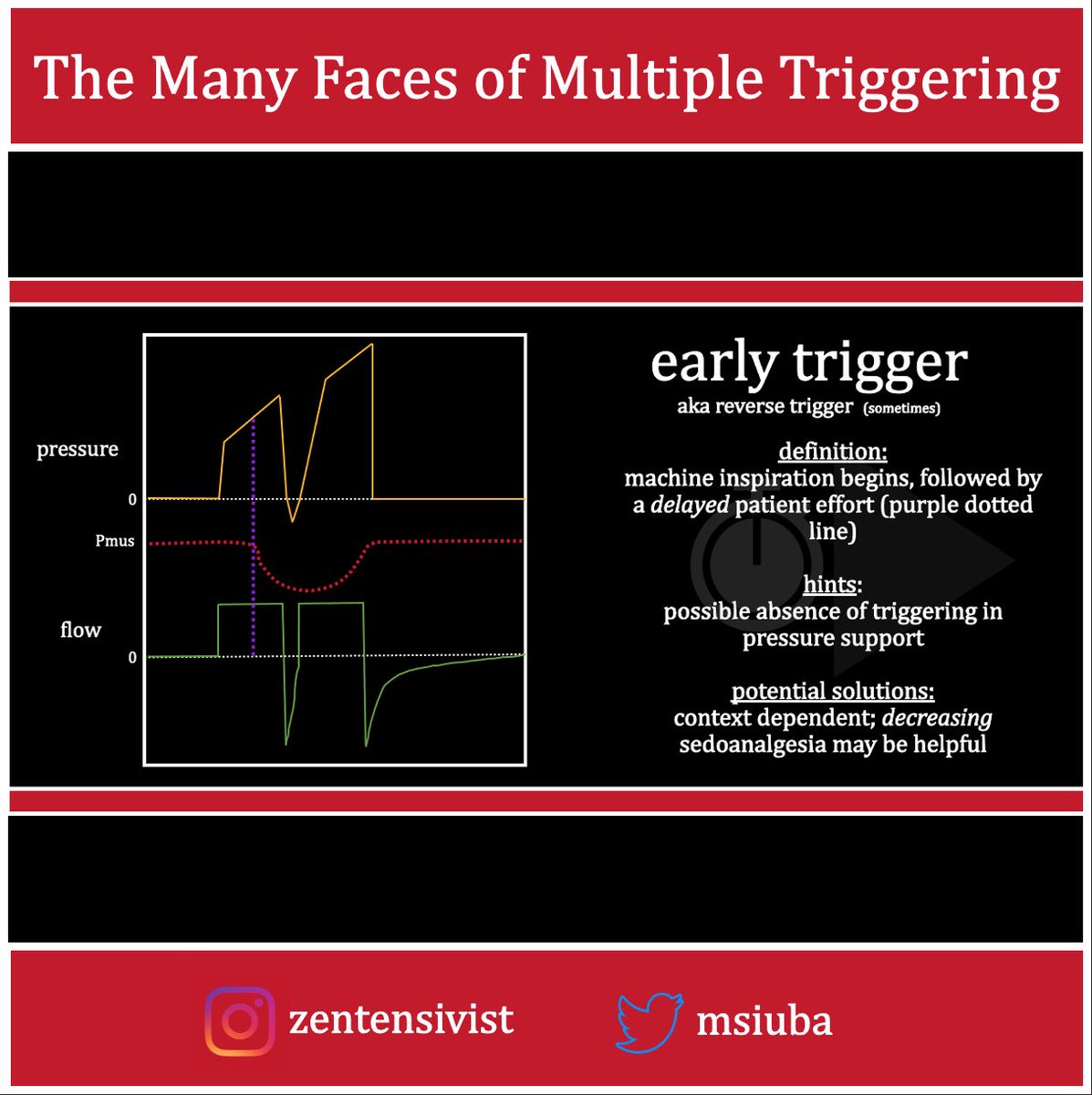 msiuba's tweet photo. New #CriticalCareNow infographic/post is live!
Not all “double stacking” is the same:
The Many Faces of Multiple Triggering
https://t.co/6NKHsWwQGe https://t.co/HelSWAVdb9