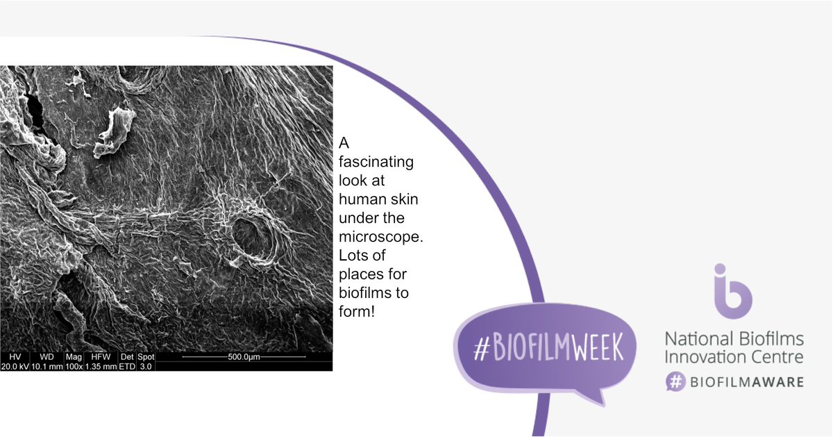Centre for Skin Sciences - CSS (@skinbradforduni) on Twitter photo Excited to share some of our brilliant images from our skin microbiome projects all provided by PhD student <a href="/PaulNor19002072/">Paul Norton</a> for #BiofilmWeek
🔎 We culture microbes on human skin ex vivo and can see them using scanning electron microscopy
<a href="/ukbiofilms/">National Biofilms Innovation Centre (NBIC)</a> #biomaterials <a href="/davidansell9/">David Ansell</a> Excited to share some of our brilliant images from our skin microbiome projects all provided by PhD student <a href="/PaulNor19002072/">Paul Norton</a> for #BiofilmWeek
🔎 We culture microbes on human skin ex vivo and can see them using scanning electron microscopy
<a href="/ukbiofilms/">National Biofilms Innovation Centre (NBIC)</a> #biomaterials <a href="/davidansell9/">David Ansell</a>