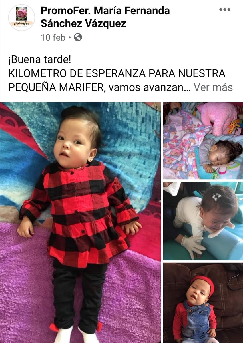Yohimarver's tweet photo. @alexa_moreno_mx @alexa_moreno_mx ojalá puedas considerar a María Fernanda es una bebé con muchas ganas de vivir, de escuchar y sobre todo de sentirse mejor cada día. Es un ejemplo de fortaleza pero se necesita mucha ayuda para poder cubrir los gastos que sus tratamientos y su próxima cirugía. 🥰 https://t.co/rShrXcCTp8