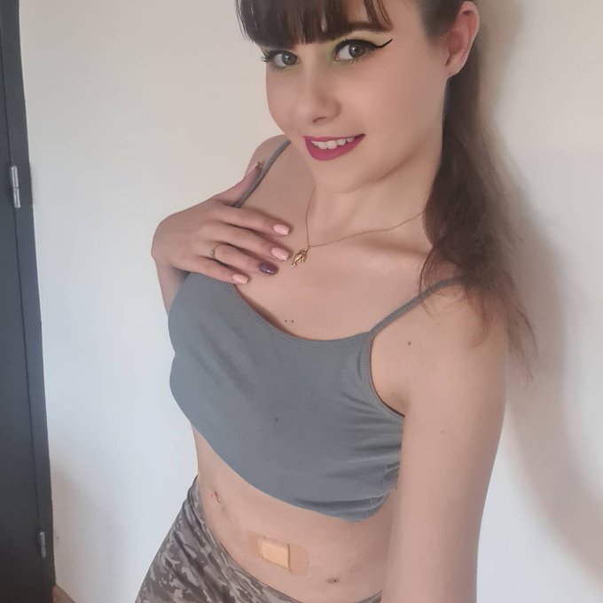 Voil&agrave; l'&eacute;volution suite &agrave; la chirurgie, au r&eacute;gime et le d&eacute;but du sport. J'ai d&eacute;j&agrave; perdu 6 kg, je trouve<a href="/tag/cam4"class="tags"><span>#cam4</span></a>