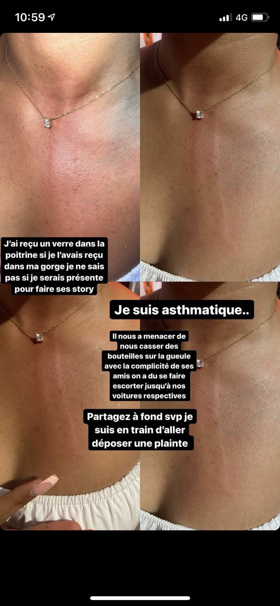 DOssiesse's tweet image. Alerte Agression sur Bordeaux .... ⛔️⛔️⛔️⛔️ je sais que Twitter fait des merveilles aider moi à trouver cet agresseur !!!! Il agresse ma pote !!! 
Pleaseeee RT FORT !!!!!