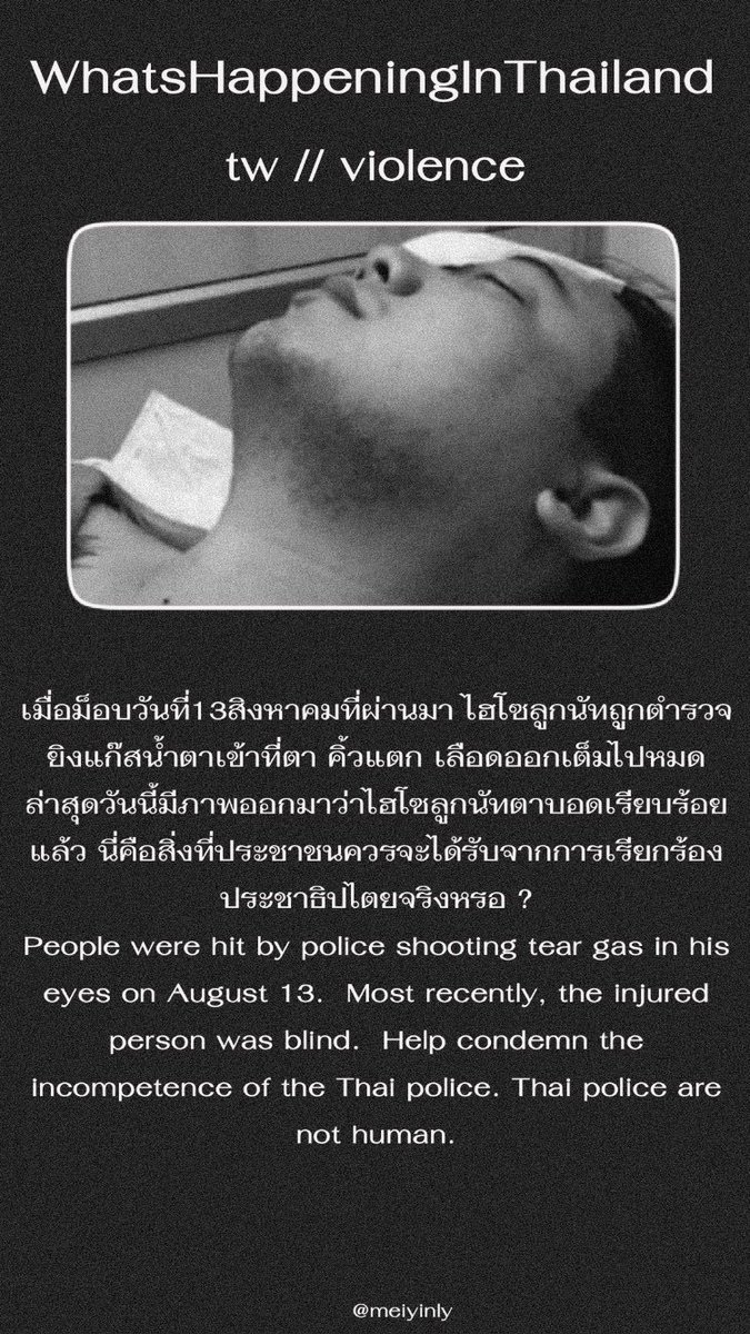 itsmexdion's tweet photo. หมดคำพูดเลย เราอยากได้ประชาธิปไตยไม่ใช่กระสุนปืน #ลูกนัทตาบอด https://t.co/MmVvAhUgvJ