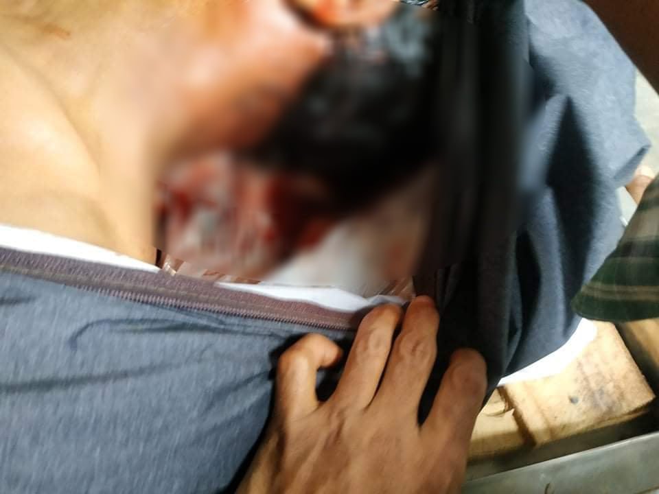 spring21MM's tweet photo. Tw\\Death,wound

Han Zaw Tun,30 yrs old man from 20th ward, #HlaingTarYar Tsp, was BEATEN to DEATH by Terrorists who were guarding at a military administration office as he passed by the office to go to work on the morning of Aug 13.

-Many injuries were found...

#Aug15Coup(1/3) https://t.co/5VTjzzkDHD
