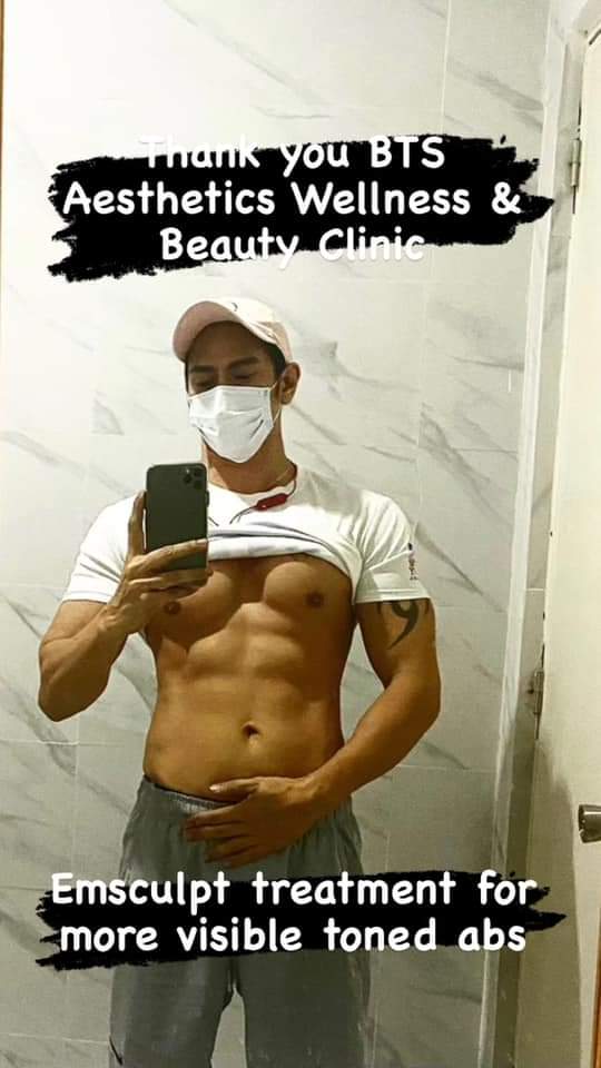 HIFU7D's tweet photo. EmSculpt Abdominal Treatment. 
For:
- Effortless Sexy Abs!
- Muscle toning 
- Nonsurgical Butt enhancement 

Use Promocode: Johnnephelim19945

Official website: https://t.co/qKtfFdRggt

#btsAesthetic #aesthetic #laspinas #abs #muscle #wellness #aestheticclinic #beauty #bts #lipo https://t.co/DlCH9SfHKT