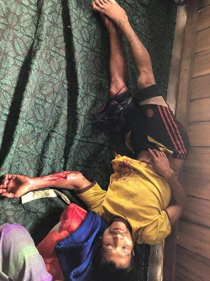 MoeLay09077555's tweet photo. tw // blood 2-year-old child &amp; his father, 30, staying inside their home were severely WOUNDED in the abdomen, arm and leg as Junta Terrorists carried out arbitrary &amp; unprovoked shootings in KanTharYone village, #Kanpetlet Tsp, #Chin State on #Aug15Coup. #WhatsHappeningInMyanmar https://t.co/IUO6TsAvxX