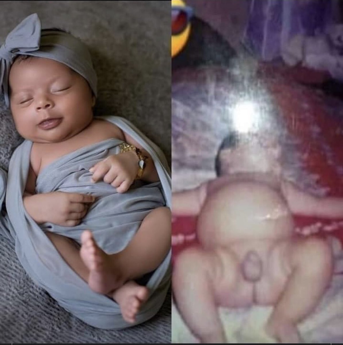 pretofinno's tweet photo. Fotos de bebê hoje em dia/ fotos de bebe antigamente https://t.co/GBHX3YlSNT