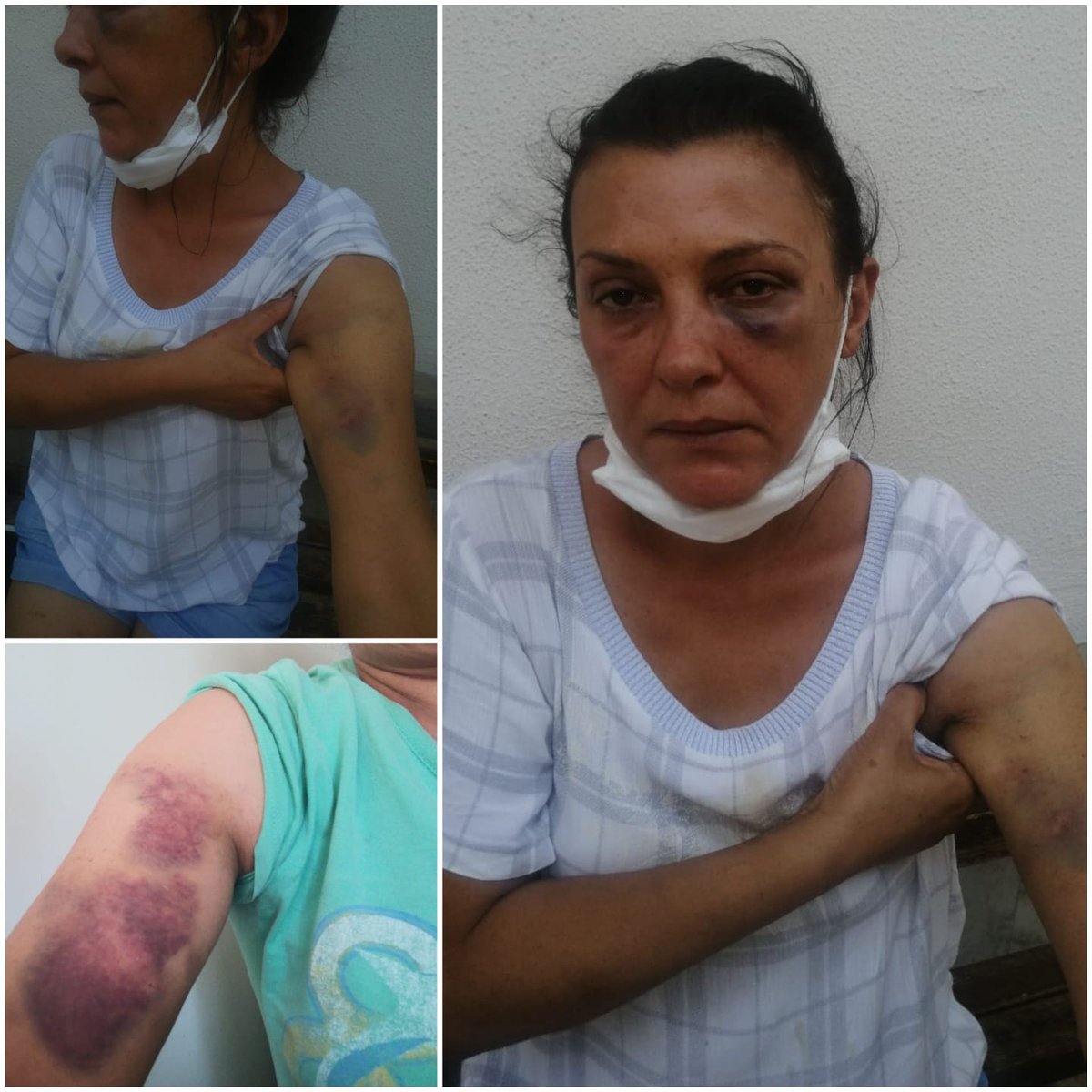 Hatice_ozdemir6's tweet photo. Merhaba ben Hatice Özdemir hayvanları beslediğim için evime zorla giren üst kat komşun dilaver pözüt ve oğlu serkan pözük tarafından şiddete uğradım. şikayetçi olmama rağmen İfadeleri alındıktan sonra serbest bırakıldılar. Buradan can güvenliğim olmadığını herkese duyuruyorum https://t.co/LzNajZRogy