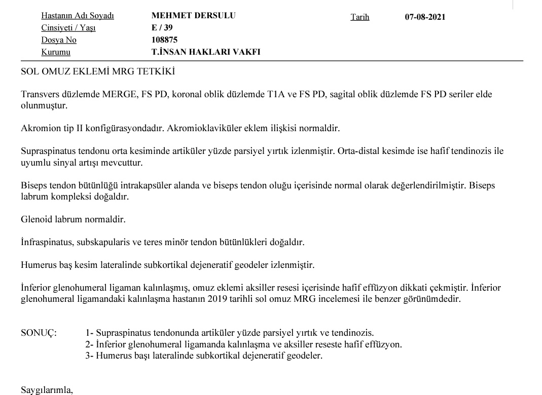 Sevgili direniş dostları,
Sol omzumdaki yırtığın tedavisi için yarın öğleden sonra 10-15 gün sürecek fizik tedaviye başlıyorum. O yüzden tedavi sürecinde akşam saat 18:00'de yaptığımız açıklamalara çıkamayacağım. Öğlen 13:30'da ise sağlam omzumla :) işimizi geri istemeye devam..