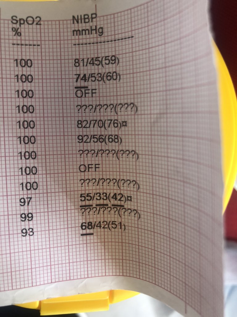 How the night is going? Why is it whenever the ER nurse says “they’re stable” they have a not stable BP on my monitor?  Is it a joke? Am I being punked? Bolus, levo, push dose epi, light and sirens to Philly we went…. Do better ER nurses! Check your septic patient frequently!