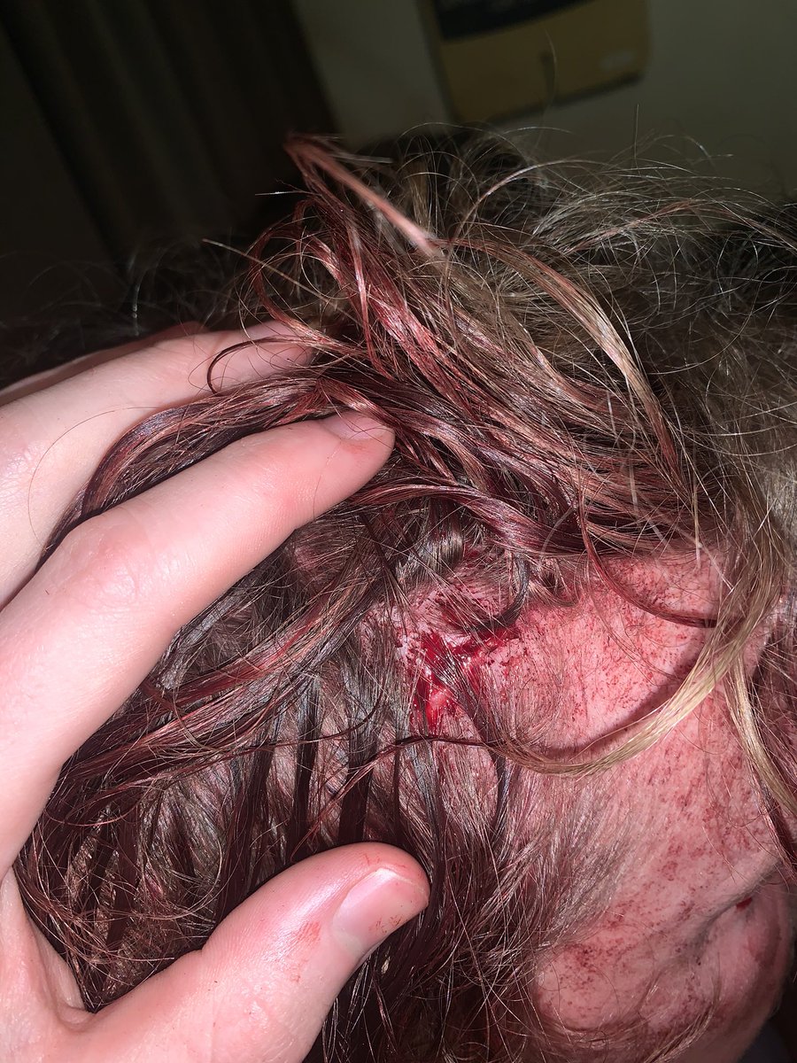 they fucked his shit up