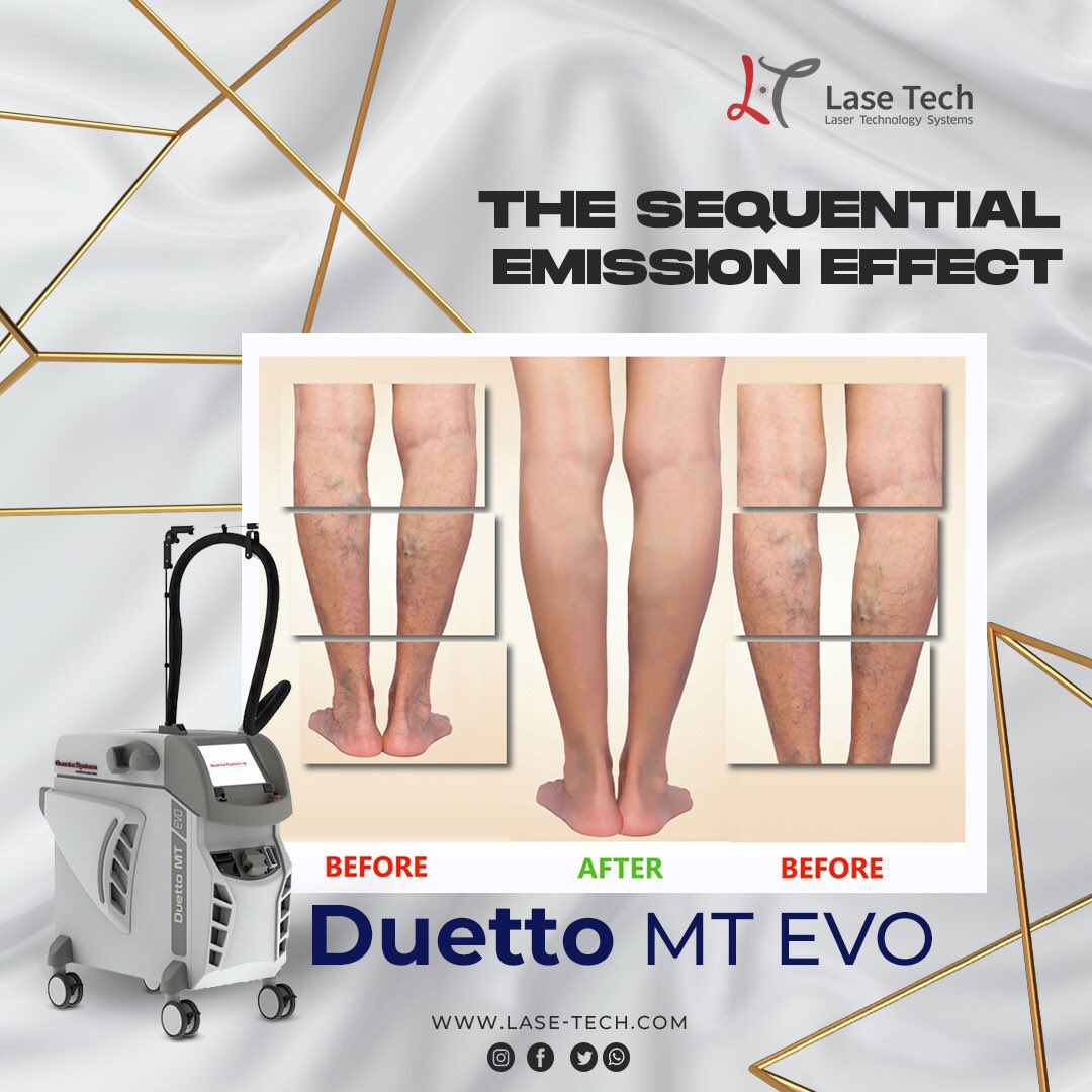laseTechsystems's tweet image. The VASCULAR treatment for the removal of facial and leg telangiectasia uses the Mixed Technology to guarantee a best result using the lowest fluences taking advantage of the different absorption of haemoglobin and methemoglobin.

Lase-tech.com

#Dubai #Quantasystem
