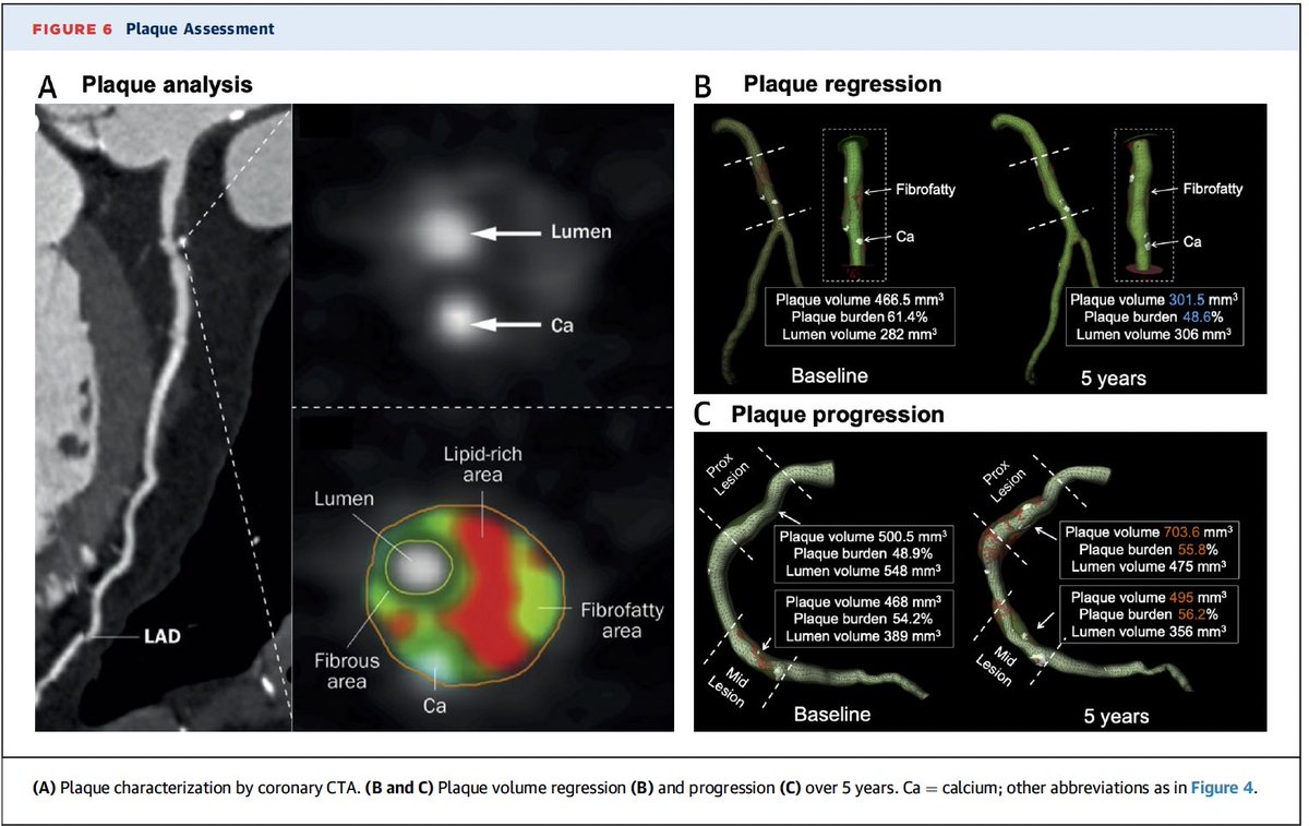 What are current technologies and literature supporting the use of coronary computed tomographic angiography in detecting coronary artery disease? @JACCJournals bit.ly/3yPKDQ1