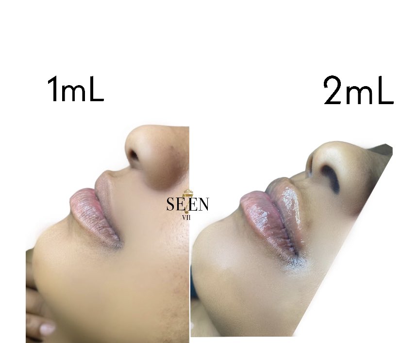 SE7ENCOSMETICS's tweet photo. First session VS second session. It is best build up each session ! 2mL can last 3-6 months 😍❤️ https://t.co/SKOUvEWePy