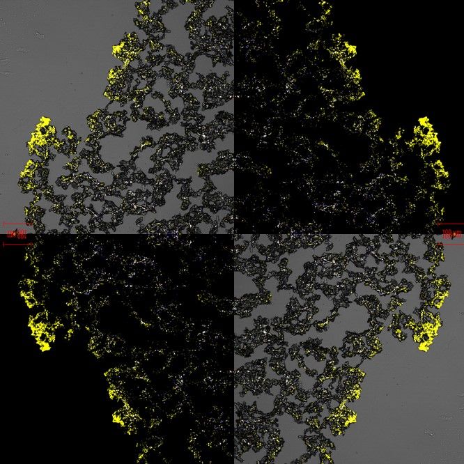 TheQuadram's tweet photo. 🔬 Here you can see biofilm formation on a polysaccharide hydrogel drug delivery matrix in the human large intestine. 

This incredible image was taken by @TTKoev @HC_Harris @Starchlab for @ukbiofilms' #BiofilmsInTheLab. View the full gallery: https://t.co/bFWSbajnN5 #BiofilmWeek https://t.co/Y3mkfZ7x1e