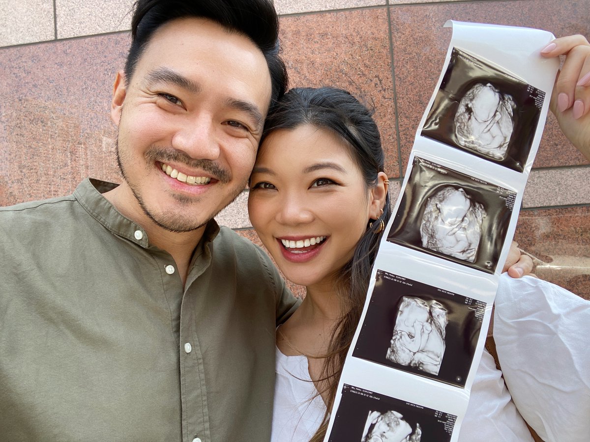 philipwang tweet media