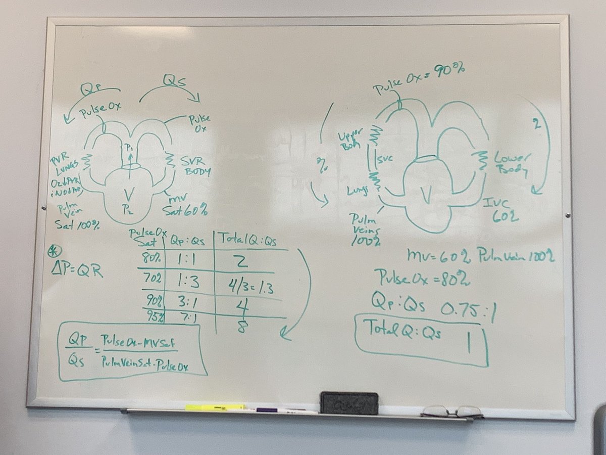 Had a white board lecture today on  single ventricle physiology by one of our senior pediatric cardiologists! #learnpicu #congenitalheartdisease