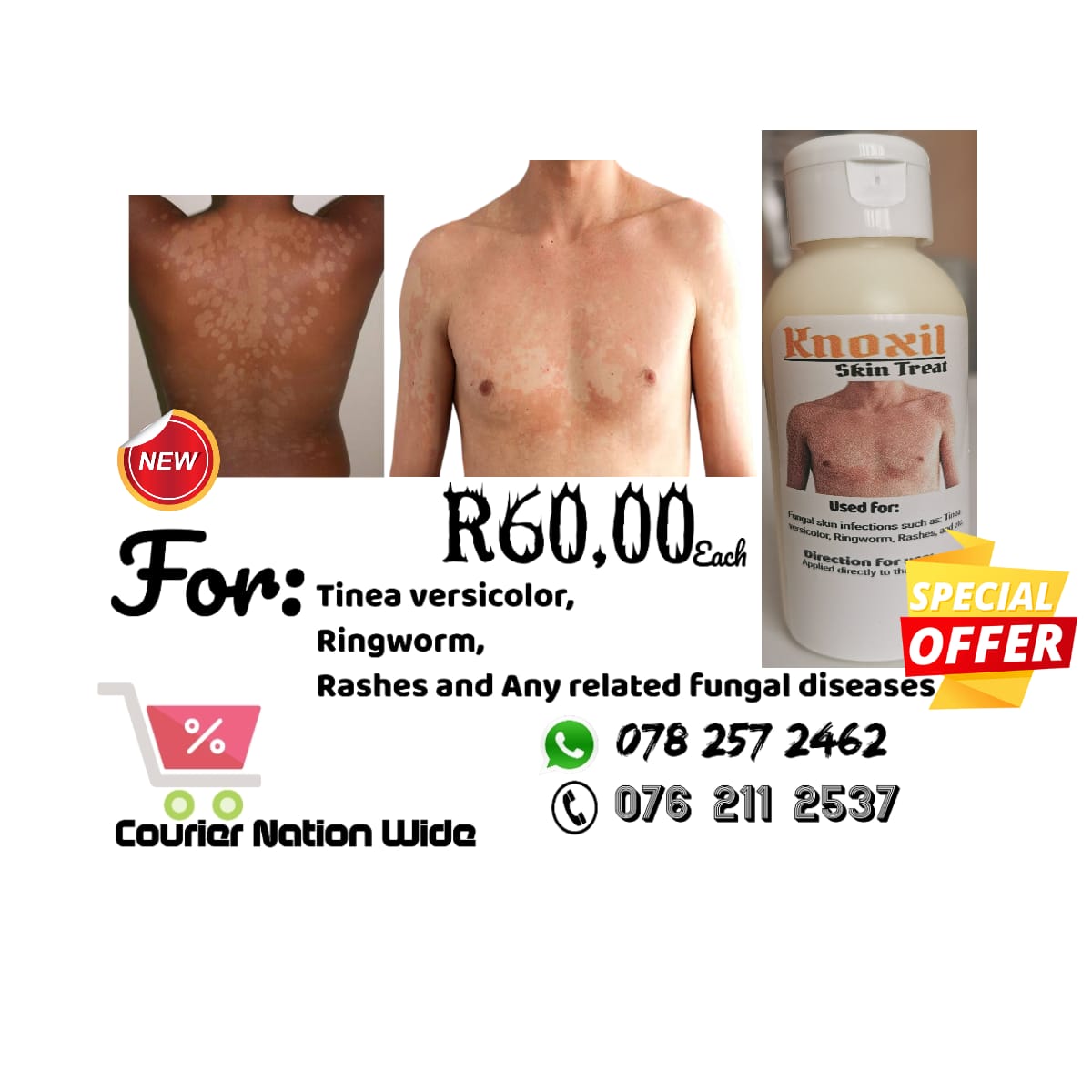 We specialize in fungal skin infections:

Such as :
-Tinea versicolor (Mulilo) 
-Ringworm (Mafata) and 
-Many more. 

WhatsApp/Call: *0782572462 / 0762112537*
-Courier Nationwide
-Resellers can contact too 🙌🏼

Mohale / Zamalek / Somizi
