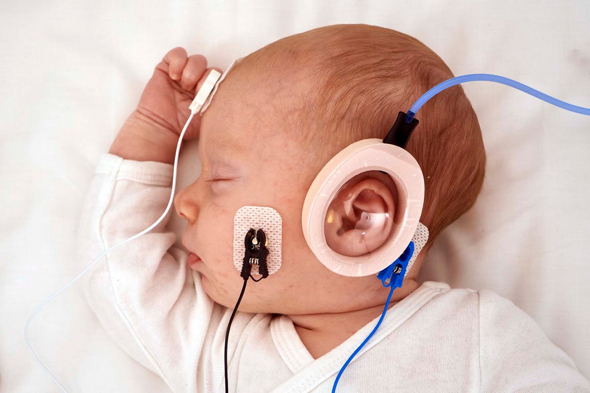 One of the many reasons why Sanibel Supply cares so much about hearing testing on infants - immensely important!

Dan Paccioretti at Pacific Audiology Group has written a short paper highlighting the importance of Universal Newborn Hearing Screening.
👉pacificaudiologygroup.com/2021/07/newbor…