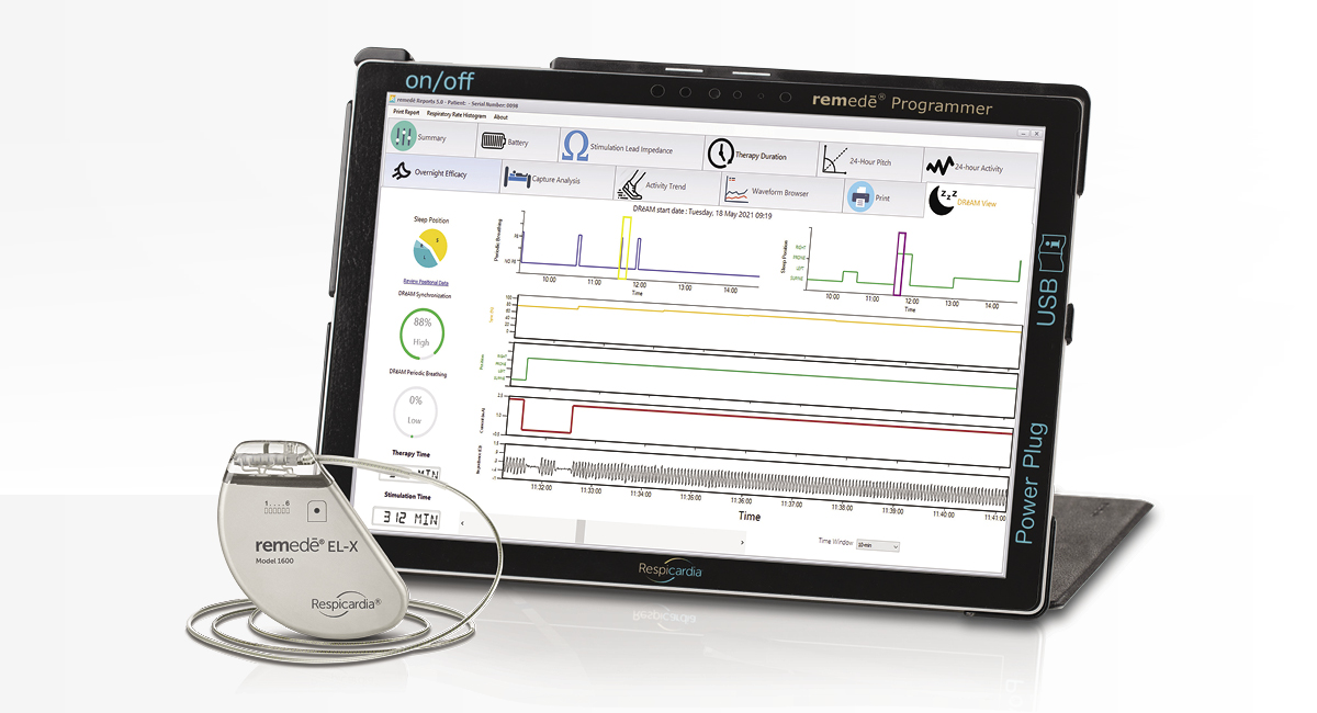 ZOLL Respicardia announces approval of next-generation remedē® System for the treatment of central sleep apnea (transvenous phrenic nerve stimulation) tinyurl.com/9rcayy9u 

Ask your doctor if remedē is right for you. For complete risk information: lnkd.in/ec-kPJV