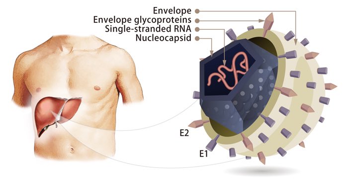في هذا الثريد سوف نتحدث عن فيروس التهاب الكبد الوبائي ج (Hepatitis C virus)

فضل التغريدة اذا كنت مش...