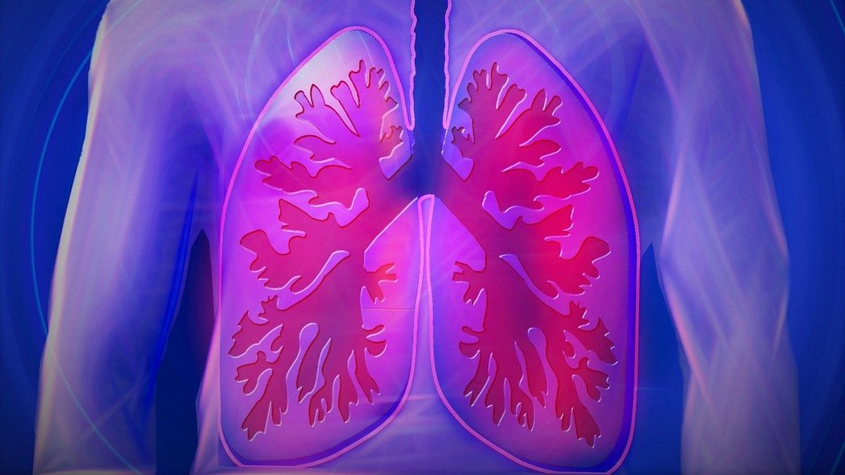 Warwick Newsroom (@warwicknewsroom) on Twitter photo Preliminary results from the RECOVERY-RS trial led by <a href="/WarwickCTU/">Warwick CTU</a> and <a href="/QUBelfast/">Queen's University Belfast 🎓</a> announced today demonstrate that continuous positive airway pressure (CPAP) reduces need for invasive mechanical ventilation in hospitalised COVID-19 patients.
Read more: bit.ly/3fxfb1j Preliminary results from the RECOVERY-RS trial led by <a href="/WarwickCTU/">Warwick CTU</a> and <a href="/QUBelfast/">Queen's University Belfast 🎓</a> announced today demonstrate that continuous positive airway pressure (CPAP) reduces need for invasive mechanical ventilation in hospitalised COVID-19 patients.
Read more: bit.ly/3fxfb1j