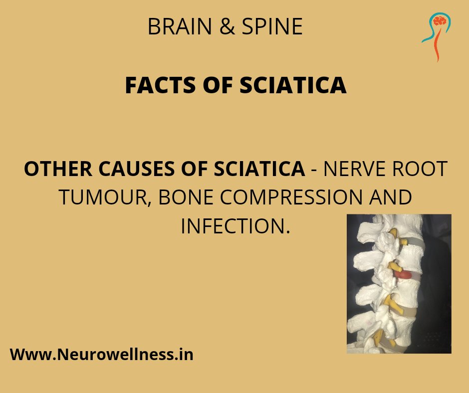 neurowellnes's tweet photo. #spinesurgery
#spinehealth
#spinecare
#neckpainrelief
#neckpainexercises#neurowellness  #spinehealth #discbulge #backpaintreatment #DiscProblems #DiscProlapse #SpineSurgeon #spinecare #sciaticarelief #sciaticapainrelief #Fortishospital #fortishospitalcunninghamroad, https://t.co/DK9Z7UShDu