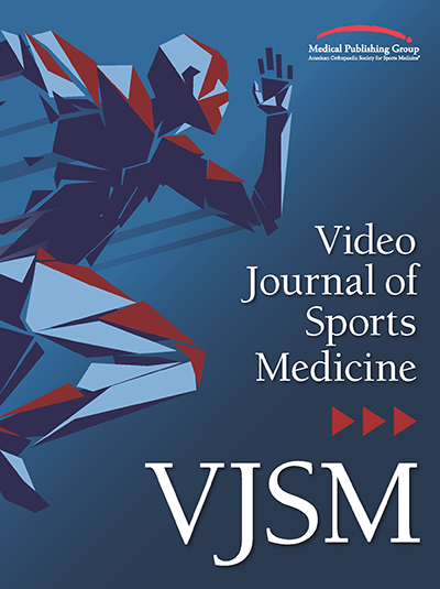 Posterior #glenoid bone loss? This new #VJSM video shows #distal #tibia #allograft technique! @Ben_Hoyt_MD #openaccess #sportsmed #orthopaedics ow.ly/SgR350FIEO2