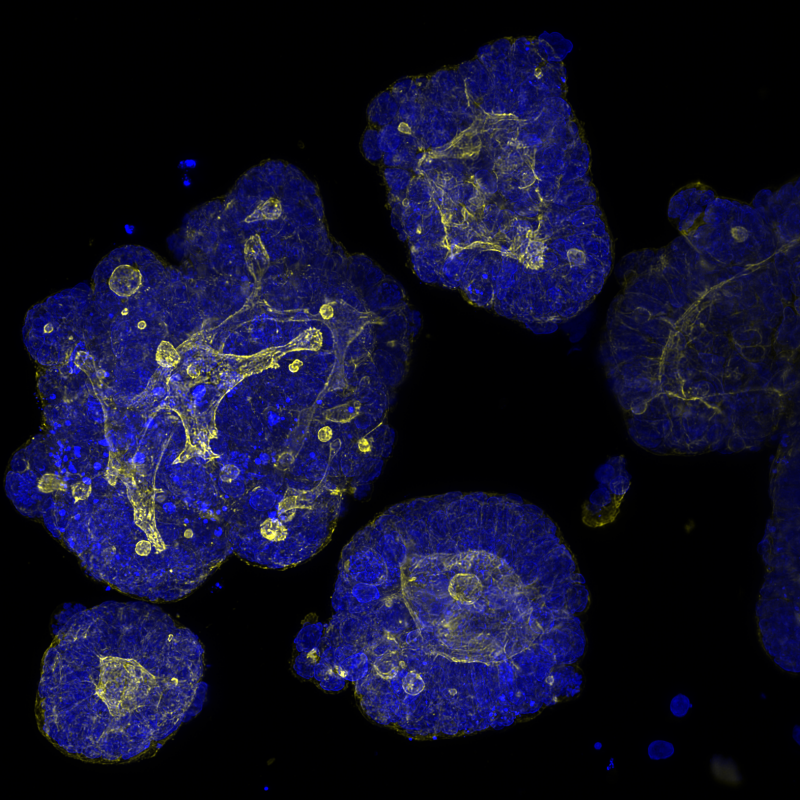 Pleased to see that the case study by A4I - @KTNUK -about our #organoid imaging project with <a href="/NPL/">NPL</a> has just been published - bit.ly/3rZcSJw
