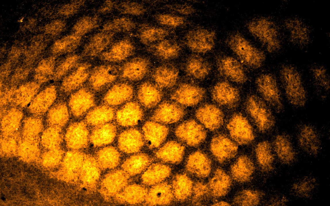 NeuroAlc's tweet photo. #SciencePhoto_IN
“Panal de abejas” 
Autora: Mar Aníbal @mar_emot0
Lab: Dra. Guillermina López Bendito @GLB_Lab
“Sección tangencial de la corteza cerebral de ratón. Inmunotinción para vGlut2 marcando los barriles corticales. Imagen adquirida con un... https://t.co/qknrkvoYrr